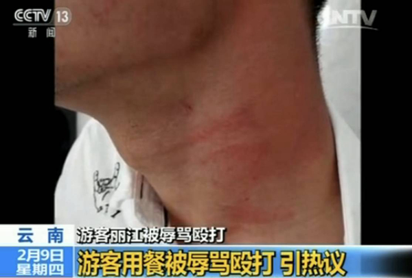 游客麗江就餐被辱罵毆打 真相到底是什么？